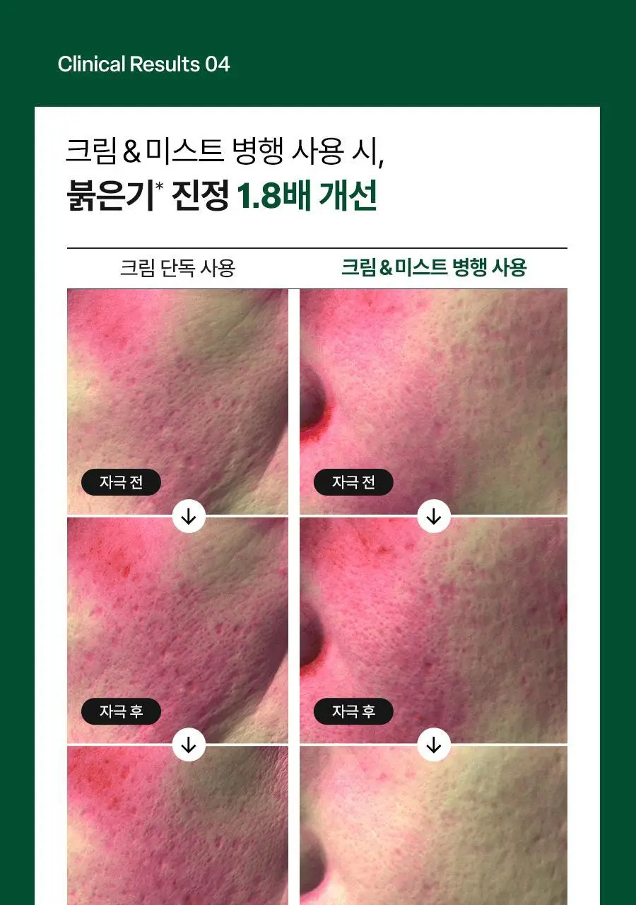 [NEW/쿨링진정] 닥터지 레드 블레미쉬 쿨 수딩 젤리 미스트 50ml 상세페이지 38